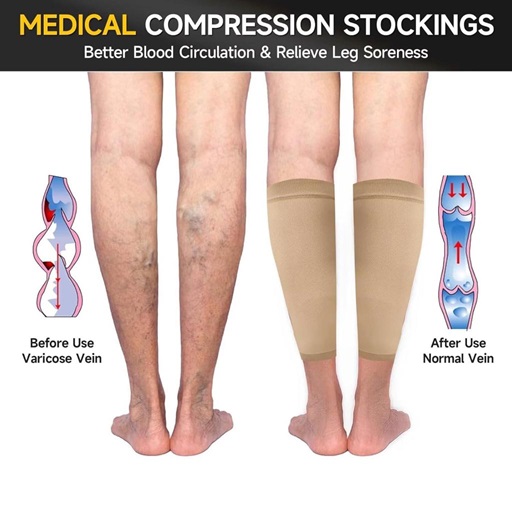 Compression stockings can help relieve symptoms associated with varicose veins.
